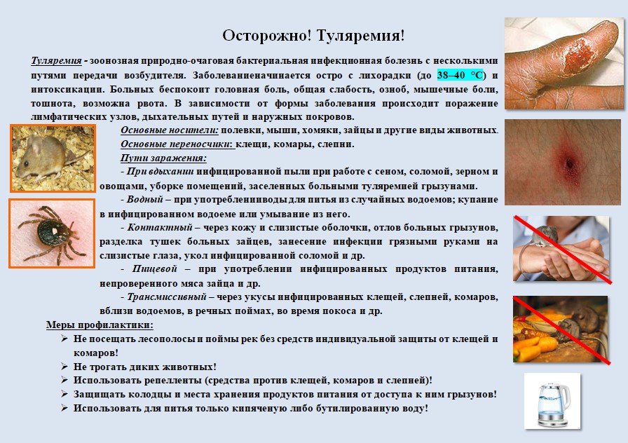 туляремия.jpg